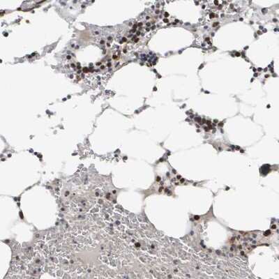Immunohistochemistry-Paraffin: CDCA5 Antibody [NBP1-89530]