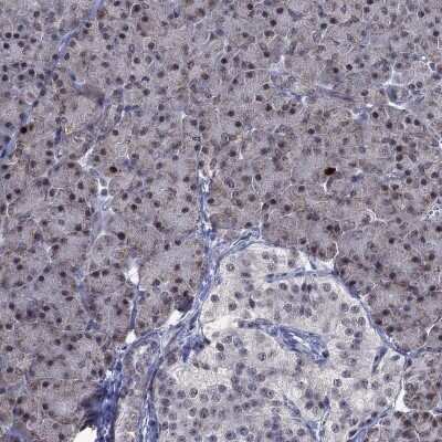 Immunohistochemistry-Paraffin: CDCA5 Antibody [NBP3-17048]