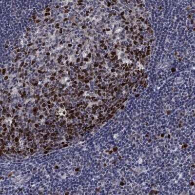 Immunohistochemistry-Paraffin: CDCA5 Antibody [NBP3-17048]