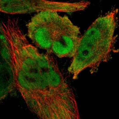 Immunocytochemistry/ Immunofluorescence: CDCA7 Antibody [NBP1-82224]