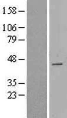 Western Blot: CDCA7 Overexpression Lysate [NBL1-09020]