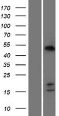 Western Blot: CDCA7 Overexpression Lysate [NBP2-06097]