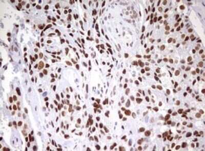 Immunohistochemistry: CDCA7L Antibody (OTI3B5) - Azide and BSA Free [NBP2-72009]