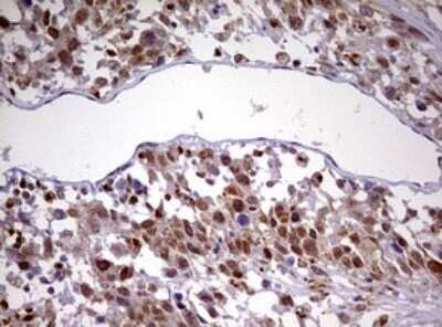 Immunohistochemistry: CDCA7L Antibody (OTI3B5) - Azide and BSA Free [NBP2-72009]