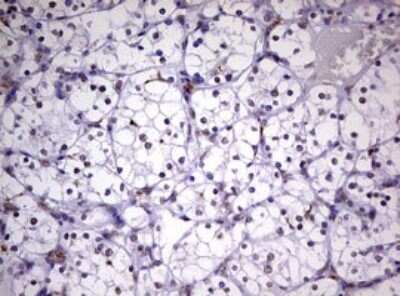 Immunohistochemistry: CDCA7L Antibody (OTI3B5) - Azide and BSA Free [NBP2-72009]
