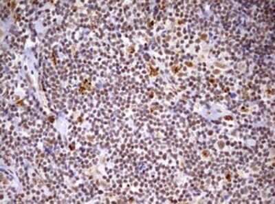 Immunohistochemistry: CDCA7L Antibody (OTI3B5) - Azide and BSA Free [NBP2-72009]