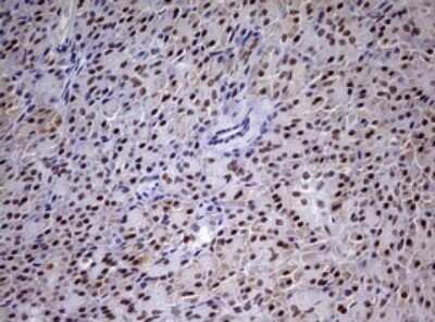 Immunohistochemistry: CDCA7L Antibody (OTI3B5) - Azide and BSA Free [NBP2-72009]
