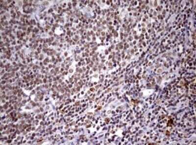 Immunohistochemistry: CDCA7L Antibody (OTI3B5) - Azide and BSA Free [NBP2-72009]