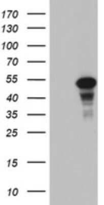 Western Blot: CDCA7L Antibody (OTI3B5)Azide and BSA Free [NBP2-72009]