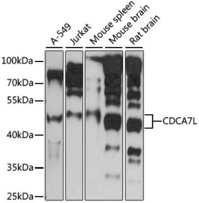 Western Blot: CDCA7L AntibodyAzide and BSA Free [NBP2-92237]