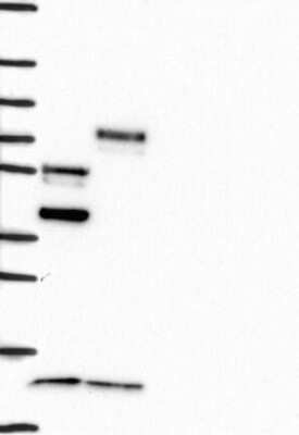 Western Blot: CDCA7L Antibody [NBP3-17194]