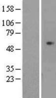 Western Blot: CDCA7L Overexpression Lysate [NBL1-09021]