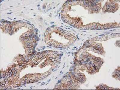 Immunohistochemistry-Paraffin: CDCP1 Antibody (OTI2C1) [NBP2-03459]