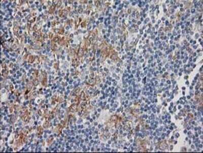 Immunohistochemistry-Paraffin: CDCP1 Antibody (OTI2C1) [NBP2-03459]