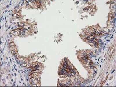 Immunohistochemistry-Paraffin: CDCP1 Antibody (OTI2C1) [NBP2-03459]