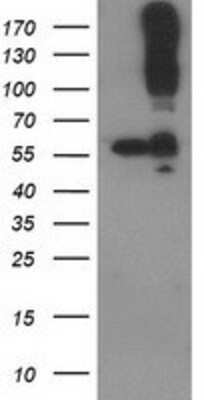 Western Blot: CDCP1 Antibody (OTI2C1) [NBP2-03459]