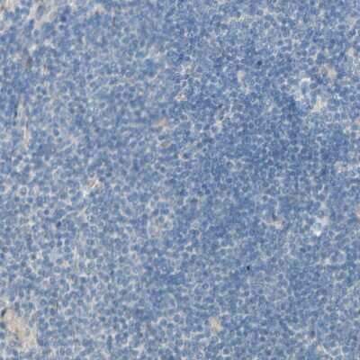 Immunohistochemistry-Paraffin: CDCP1 Antibody [NBP1-85758]