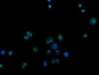 Immunocytochemistry/ Immunofluorescence: CDCP1 Antibody (OTI2C1) - Azide and BSA Free [NBP2-72156]