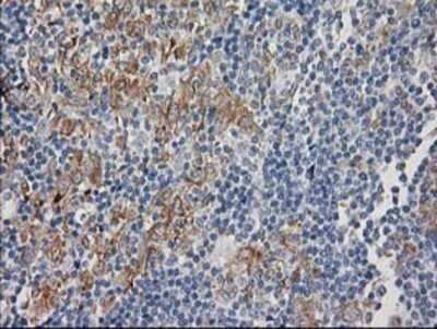 Immunohistochemistry: CDCP1 Antibody (OTI2C1) - Azide and BSA Free [NBP2-72156]
