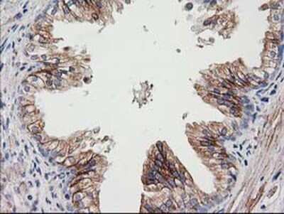 Immunohistochemistry: CDCP1 Antibody (OTI2C1) - Azide and BSA Free [NBP2-72156]