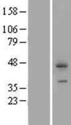 Western Blot: CDCP1 Overexpression Lysate [NBP2-04991]