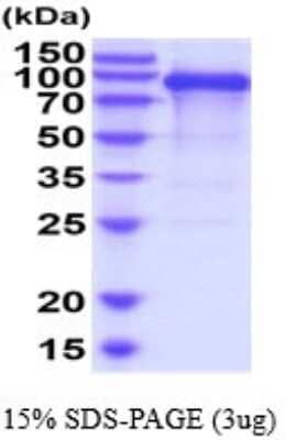 SDS-PAGE: Recombinant Human CDCP1 His Protein [NBP2-52306]