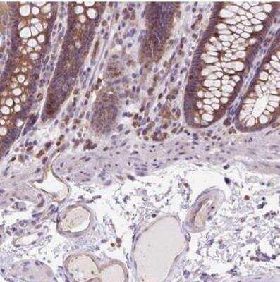 Immunohistochemistry-Paraffin: CDGSH Iron Sulfur Domain 3 Antibody [NBP2-30886]