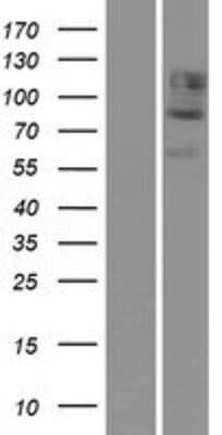 Western Blot: Cadherin-12 Overexpression Lysate [NBP2-07917]