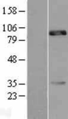 Western Blot: Cadherin-18 Overexpression Lysate [NBL1-09029]