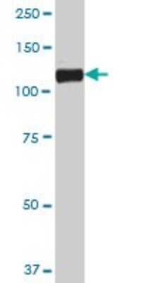 Western Blot: Cadherin-19 Antibody [H00028513-B01P]