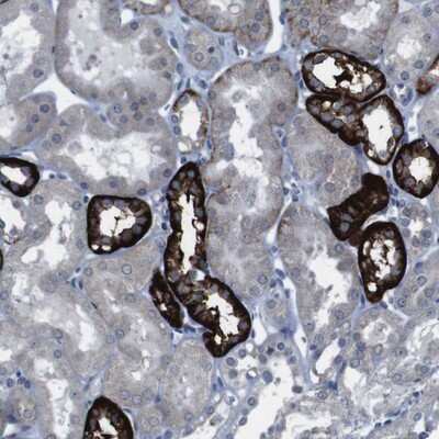 Immunohistochemistry-Paraffin: Cadherin-22 Antibody [NBP1-88300]