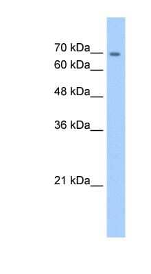 Western Blot: Cadherin-22 Antibody [NBP1-60069]