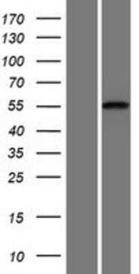 Western Blot: Cadherin-23 Overexpression Lysate [NBP2-05857]