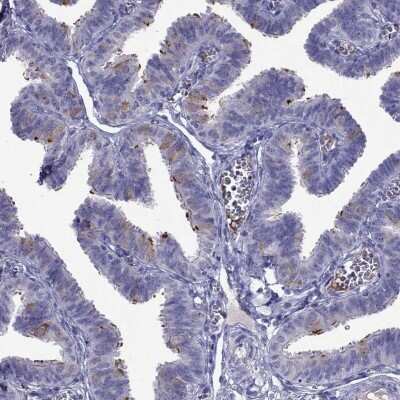 Immunohistochemistry-Paraffin: CDHR4 Antibody [NBP2-62703]