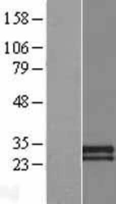 Western Blot: CDHR4 Overexpression Lysate [NBP2-08818]