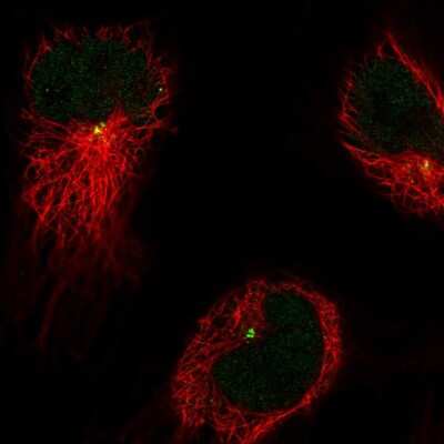 Immunocytochemistry/ Immunofluorescence: CDIP Antibody [NBP2-14381]