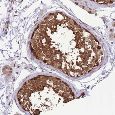 Immunohistochemistry-Paraffin: CDIP Antibody [NBP2-14381]