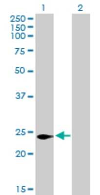 Western Blot: CDIP Antibody [H00029965-B01P]