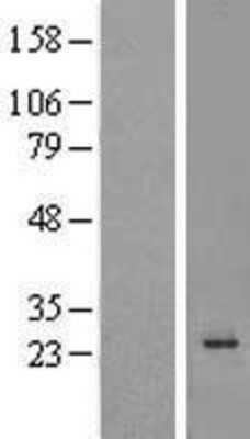 Western Blot: CDIP Overexpression Lysate [NBL1-08215]