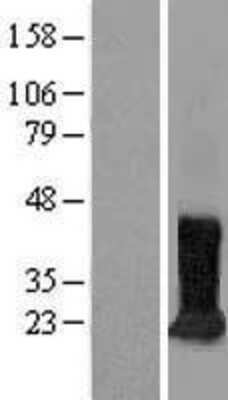 Western Blot: CDIPT Overexpression Lysate [NBL1-09036]