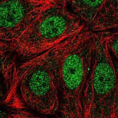 Immunocytochemistry/ Immunofluorescence: CDK10 Antibody [NBP2-55913]