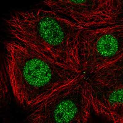 Immunocytochemistry/ Immunofluorescence: CDK10 Antibody [NBP2-57779]