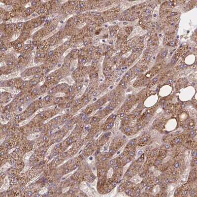 Immunohistochemistry: CDK10 Antibody [NBP2-68579]