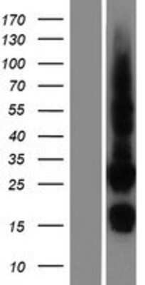 Western Blot: CDK10 Overexpression Lysate [NBP2-05828]