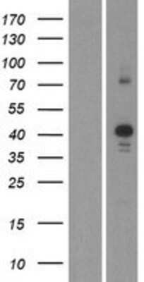 Western Blot: CDK10 Overexpression Lysate [NBP2-05829]