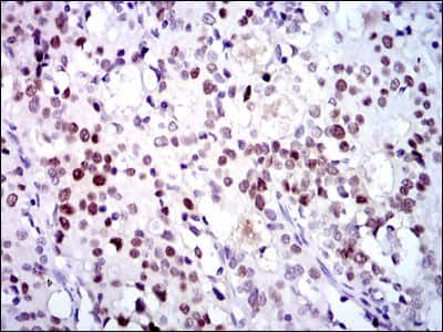 Immunohistochemistry-Paraffin: CDK2 Antibody (1A6) - BSA Free [NBP2-37507]