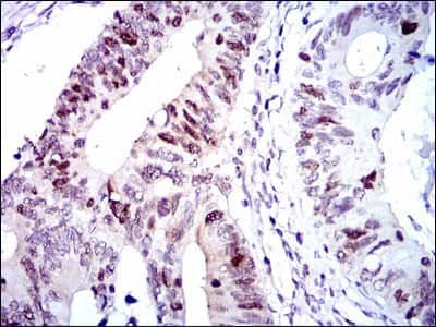 Immunohistochemistry-Paraffin: CDK2 Antibody (1A6) - BSA Free [NBP2-37507]