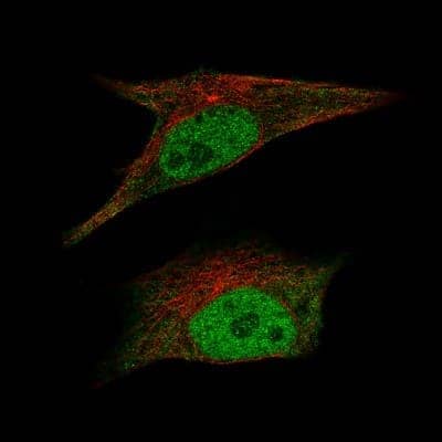 Immunocytochemistry/ Immunofluorescence: CDK2 Antibody (CL7990) [NBP2-88911]
