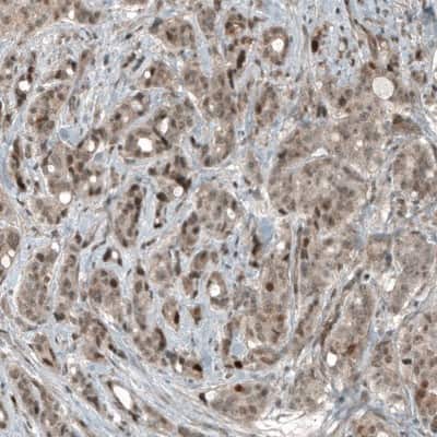 Immunohistochemistry-Paraffin: CDK2 Antibody (CL7990) [NBP2-88911]