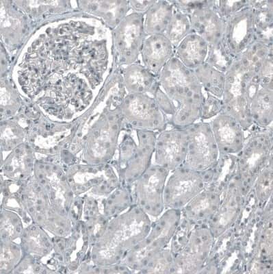 Immunohistochemistry-Paraffin: CDK2 Antibody (CL7990) [NBP2-88911]